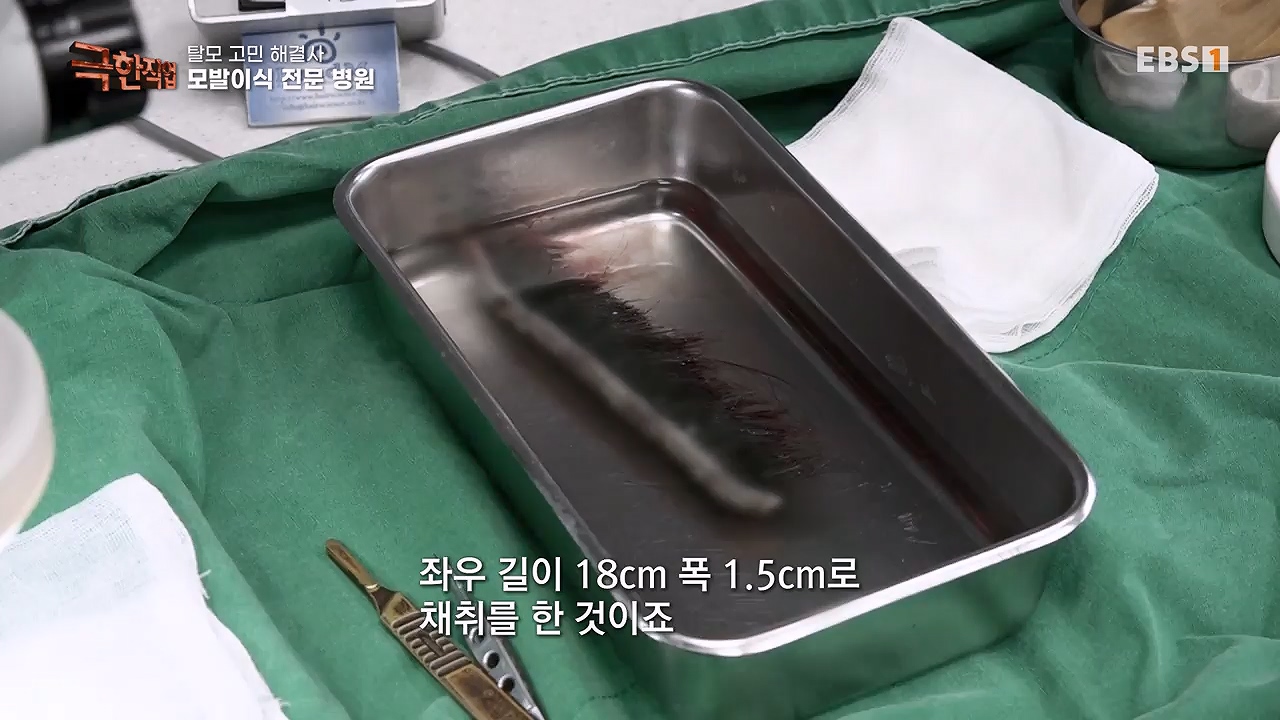 TV - 전 국민의 평생학교 EBS탈모 고민 해결사.mp4_20230508_195805.413.jpg