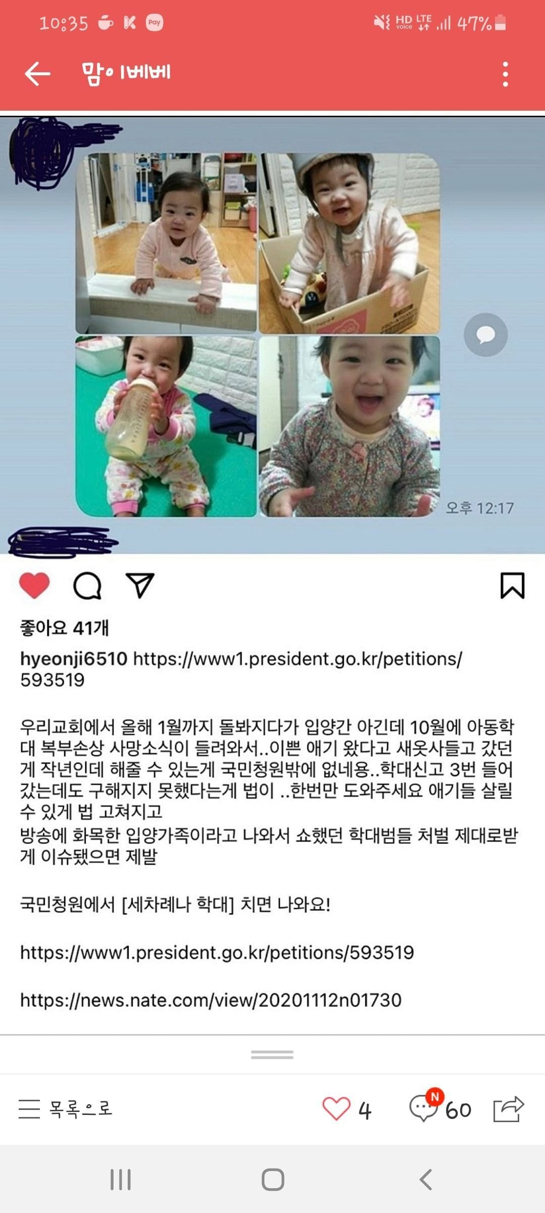  그알 아동학대당한 16개월 정인이 입양 전후와 사망 하루 전 모습