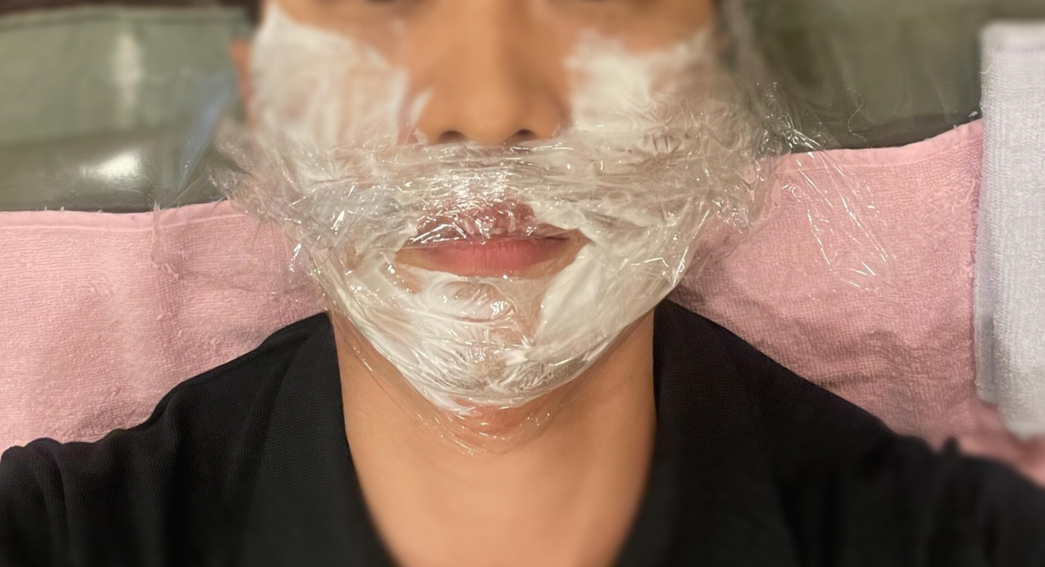  수유역 수염 레이저 제모 후기- 가격과 고통