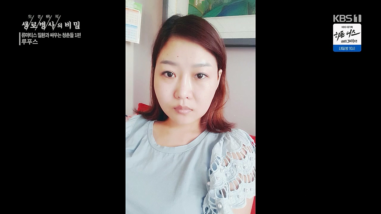 생로병사의 비밀.E860.230316p.H264-F1RST.mp4_20230316_220921.323.jpg