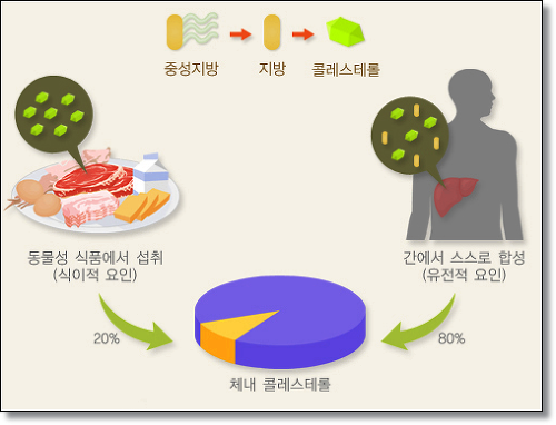 고지혈증 사진