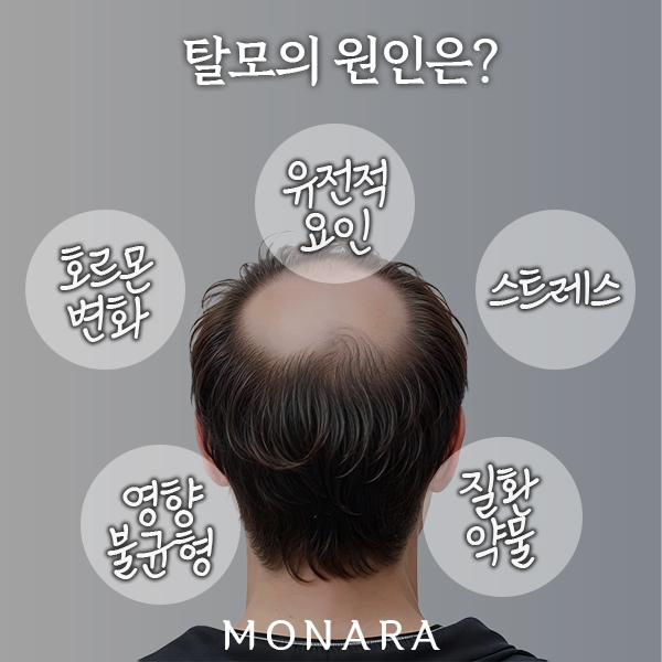 탈모의 모든 것이 가능한 강남탈모병원