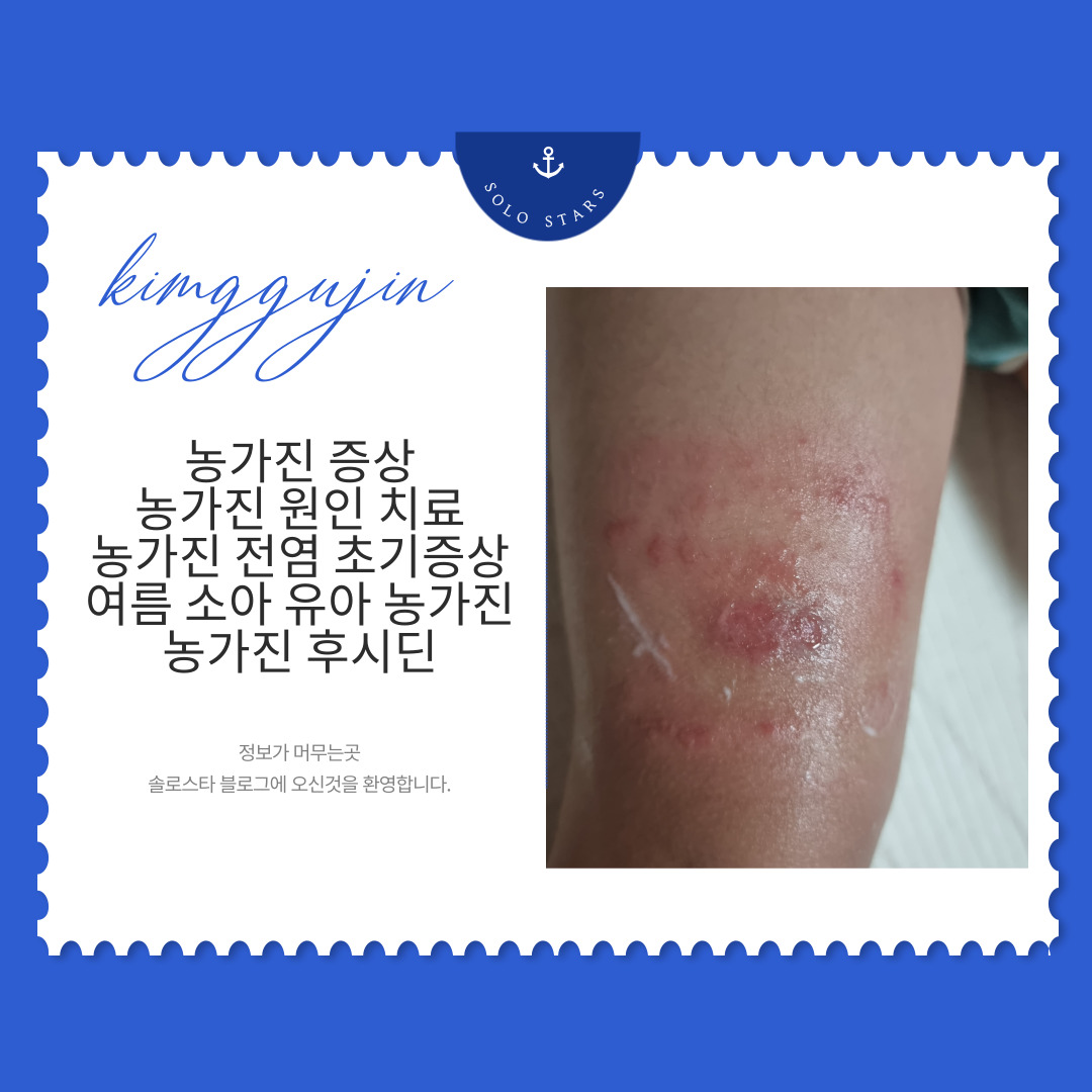 농가진 관련 사진