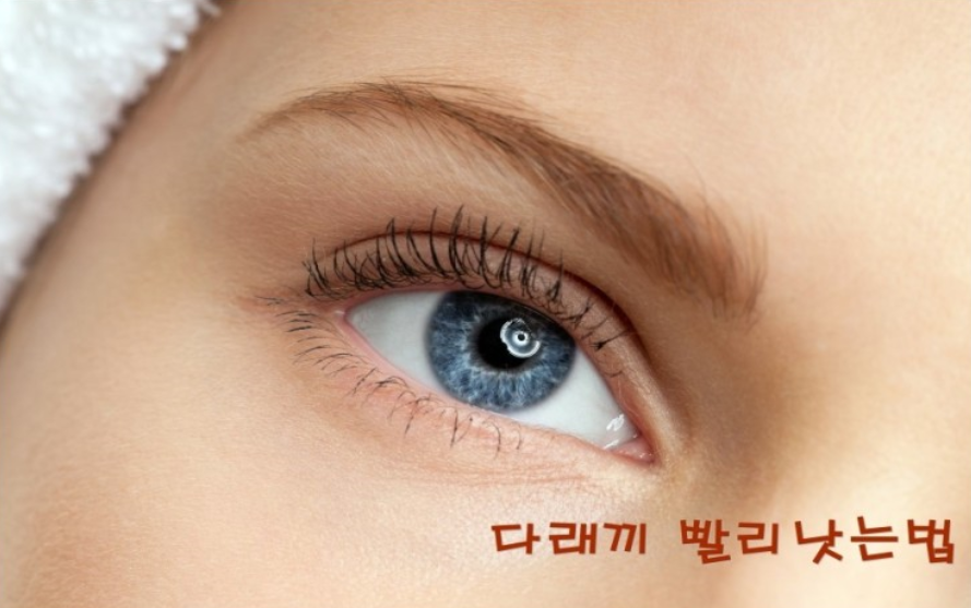  다래끼 빨리낫는법 효과적인 3가지 알아보세요