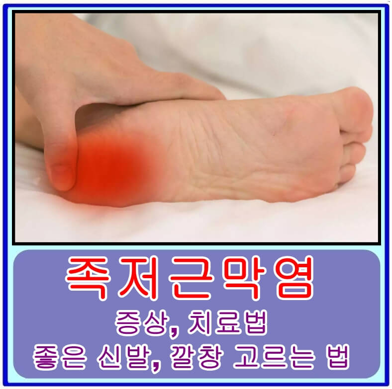  족저근막염의 증상, 치료법 및 좋은 신발, 깔창 고르는 법