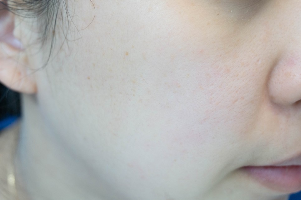 ginger 스킨케어의 시작은 이중기능성토너인 14