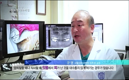 [670회] 생로병사의 비밀 - KBS670회] 생로병사의 비밀.ts_20220505_143058.475.jpg