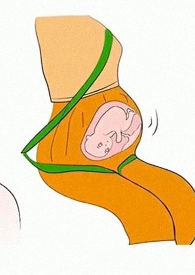  임산부용 안전벨트