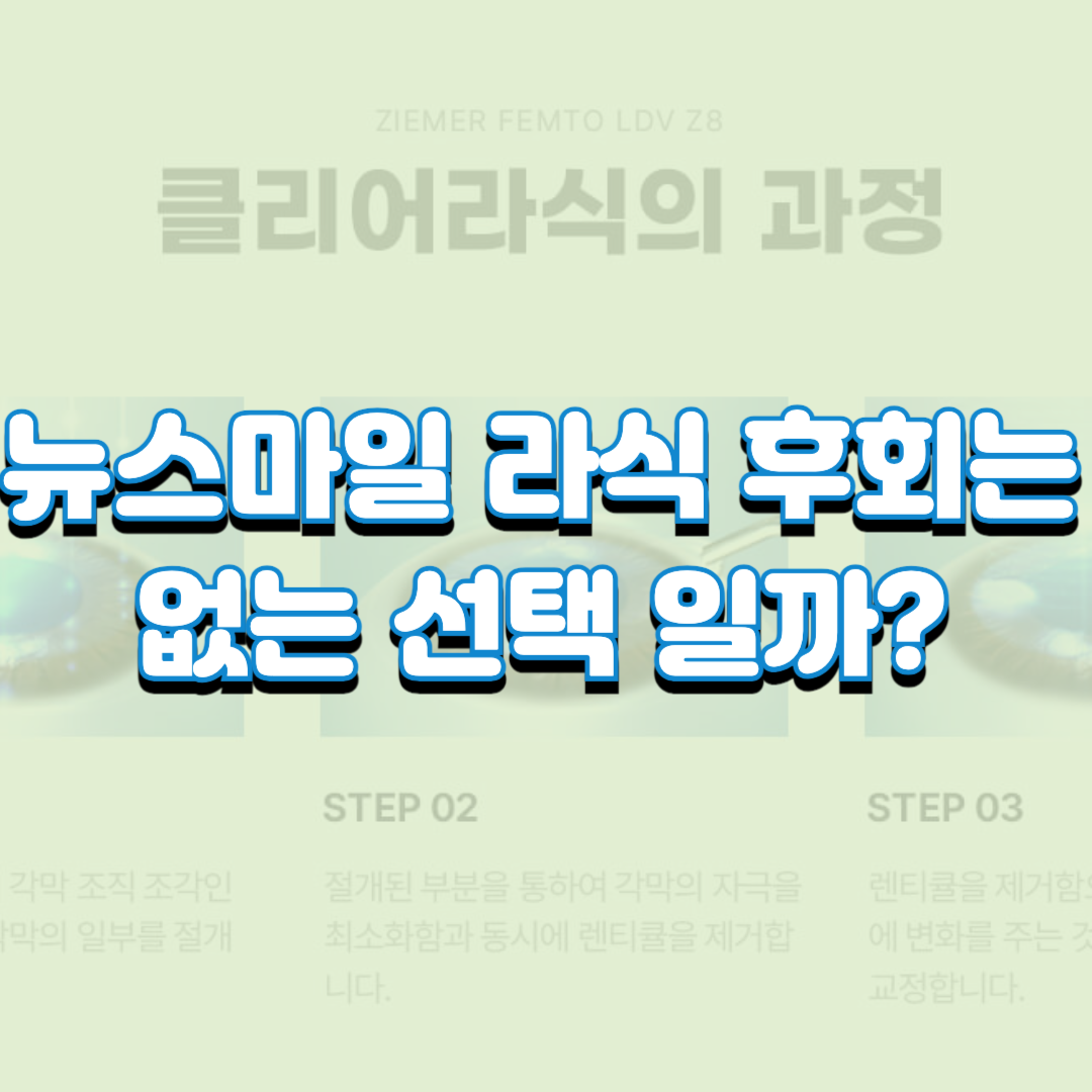  뉴스마일 라식 후회는 없는 선택 일까?