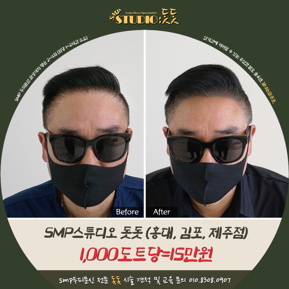  헤어라인 문신 가격과 자세한 작업 절차