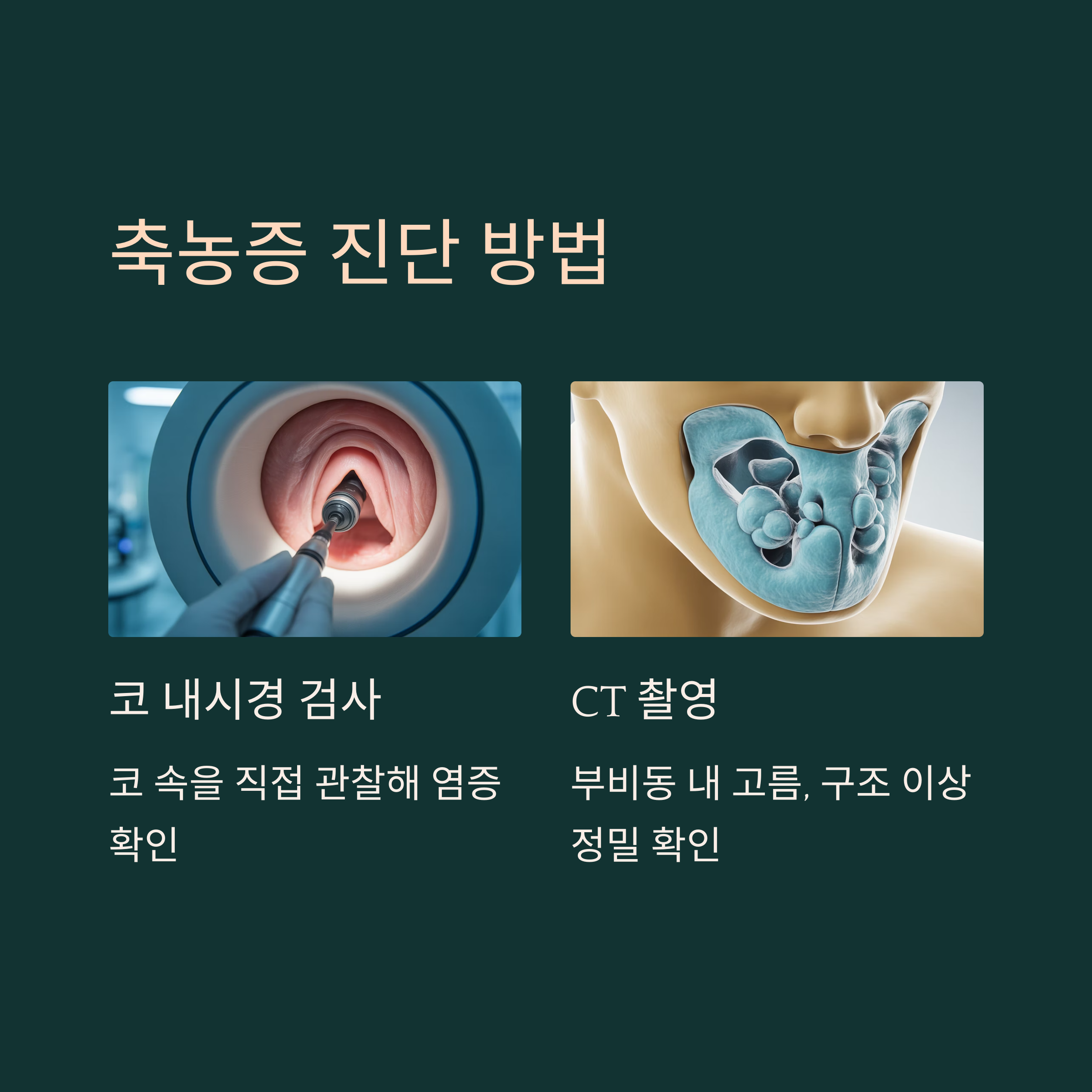 축농증 진단은 어떻게 하나요?