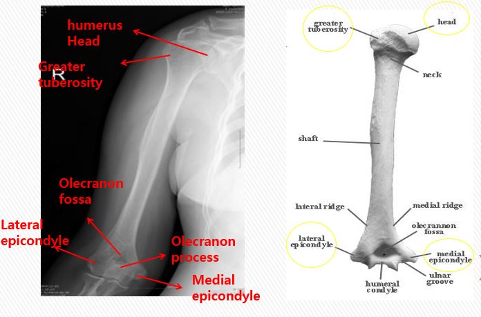 Humerus AP
