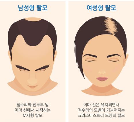 바이오가-바이오틴-탈모샴푸-효능-효과