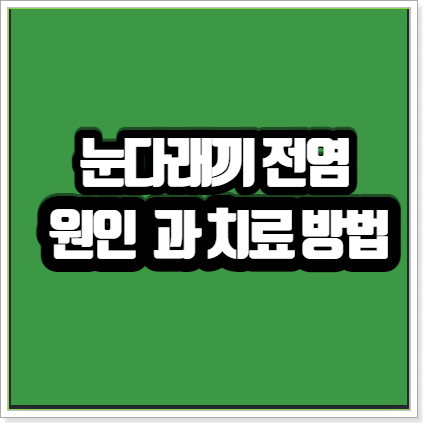  눈다래끼전염 여부 다래끼빨리낫는법