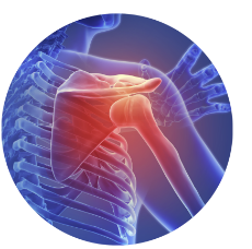 고관절 통증 증상