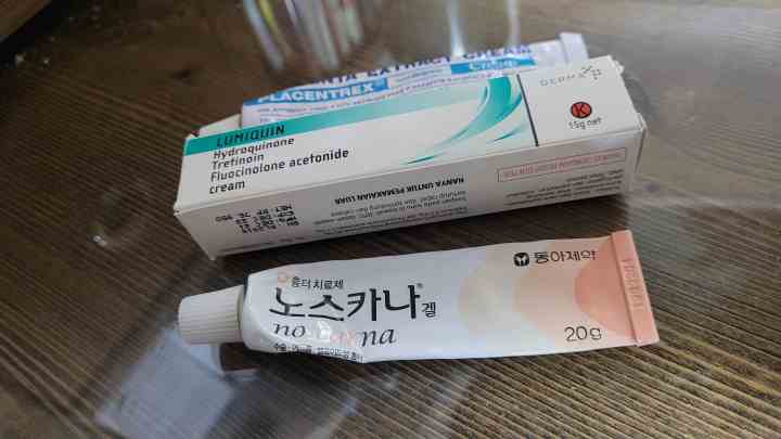  여드름 흉터 연고 노스카나겔  실제 사용후기