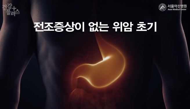  위암 초기증상 3기 생존율은?