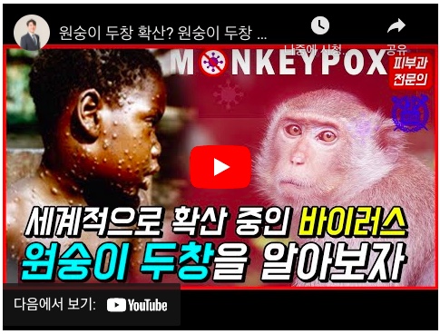  원숭이두창 유래 백신 코로나19 유행여부 533