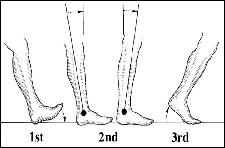 일반적인 보행을 하는 동안의 발이 지면에 닿고 떨어지는 과정을 그림으로 나타낸 것.