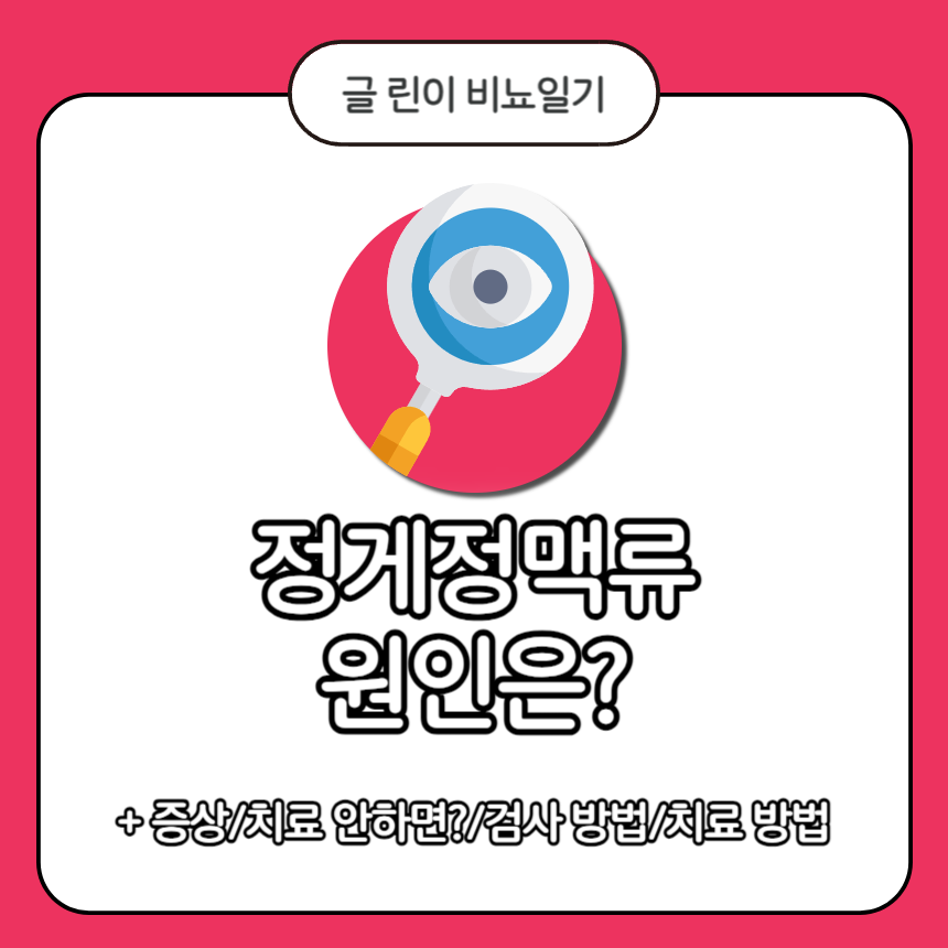  정계정맥류 원인은?