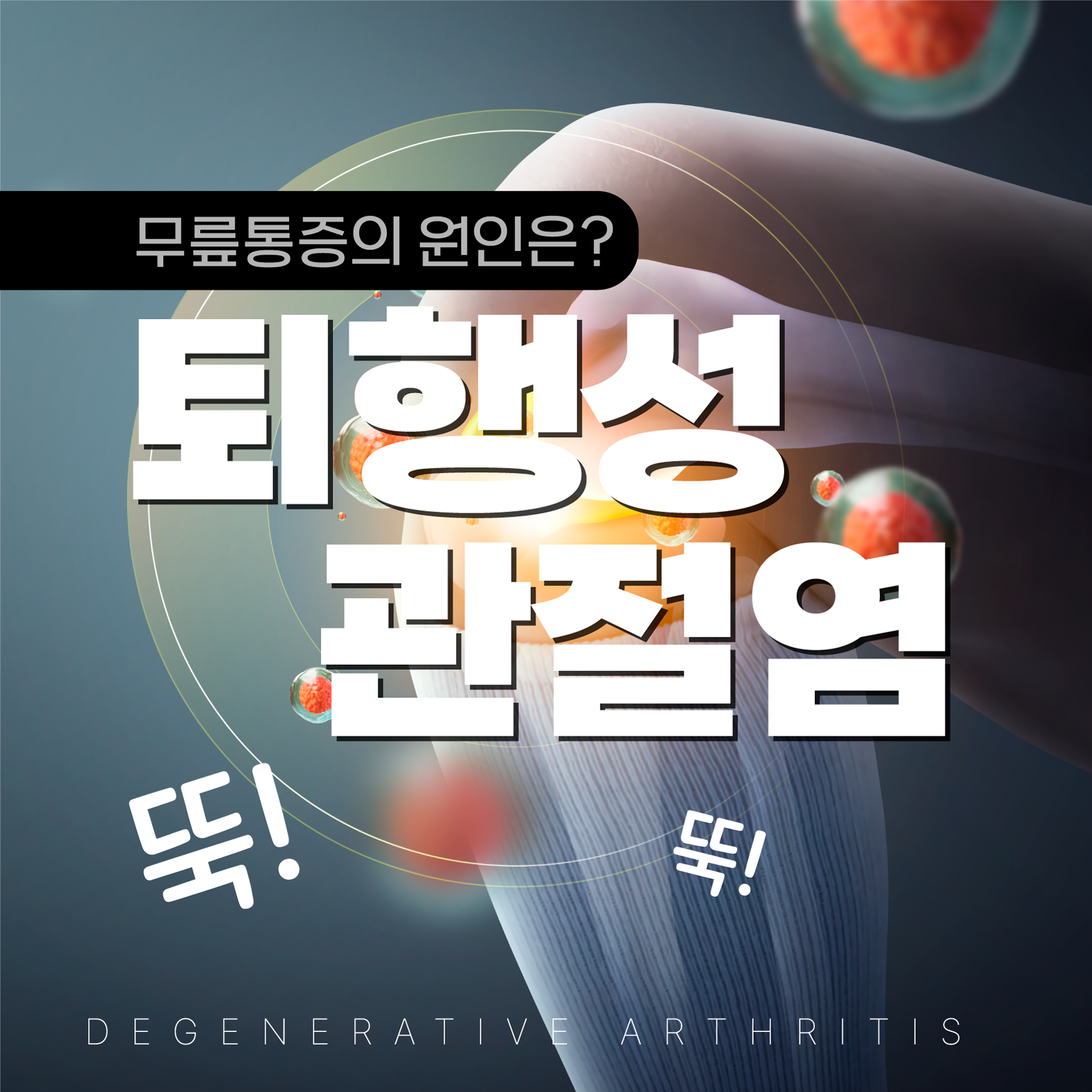  연신내역통증클리닉, 젊은 퇴행성관절염 환자 증가 이렇게 예방하자