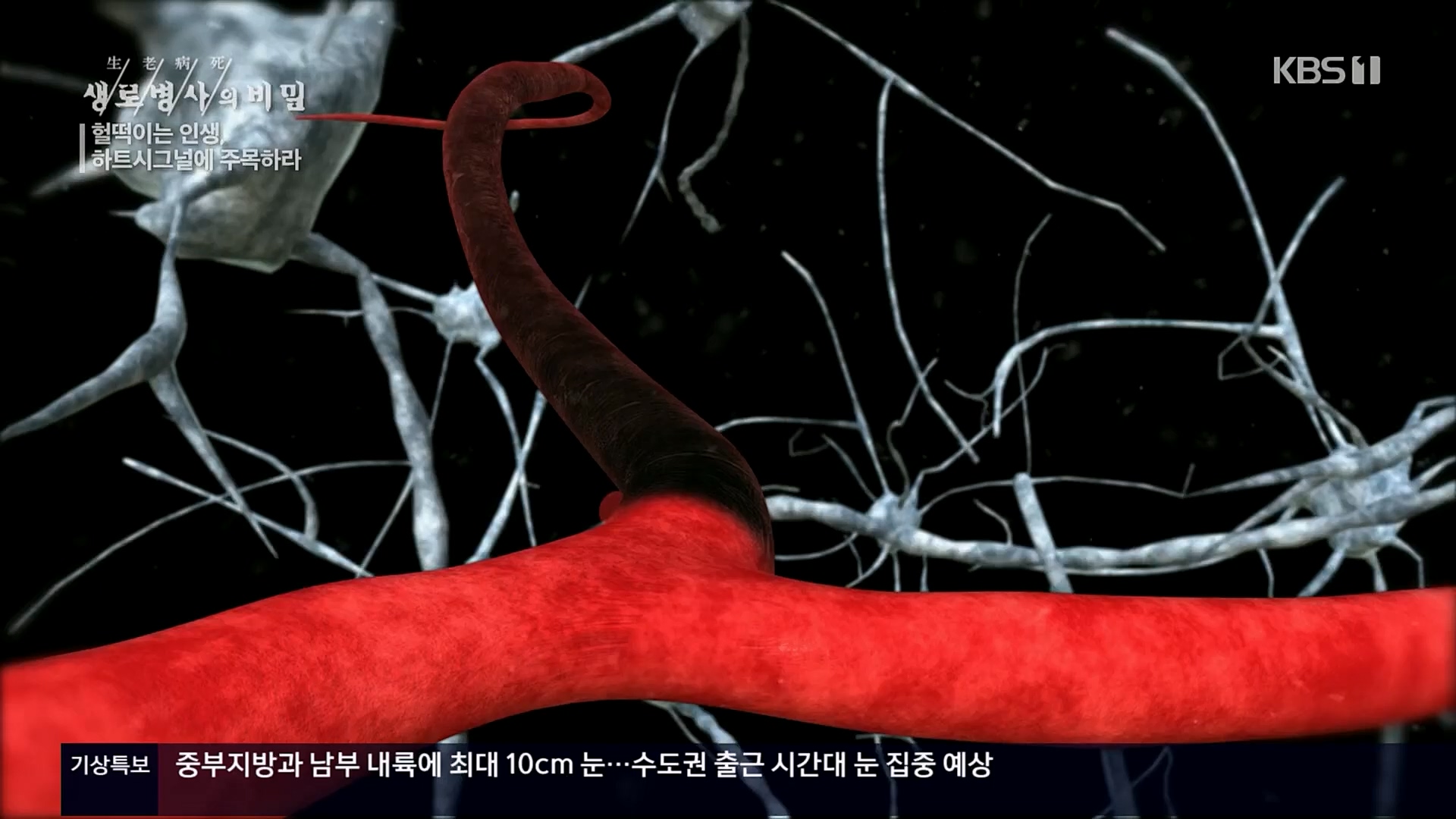 생로병사의 비밀.E853.230125p.H264-F1RST.mp4_20230210_203706.715.jpg