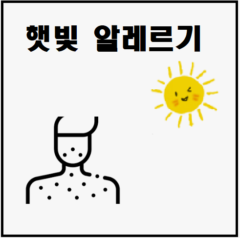  햇빛 알레르기 증상 원인 대처방법 자가진단