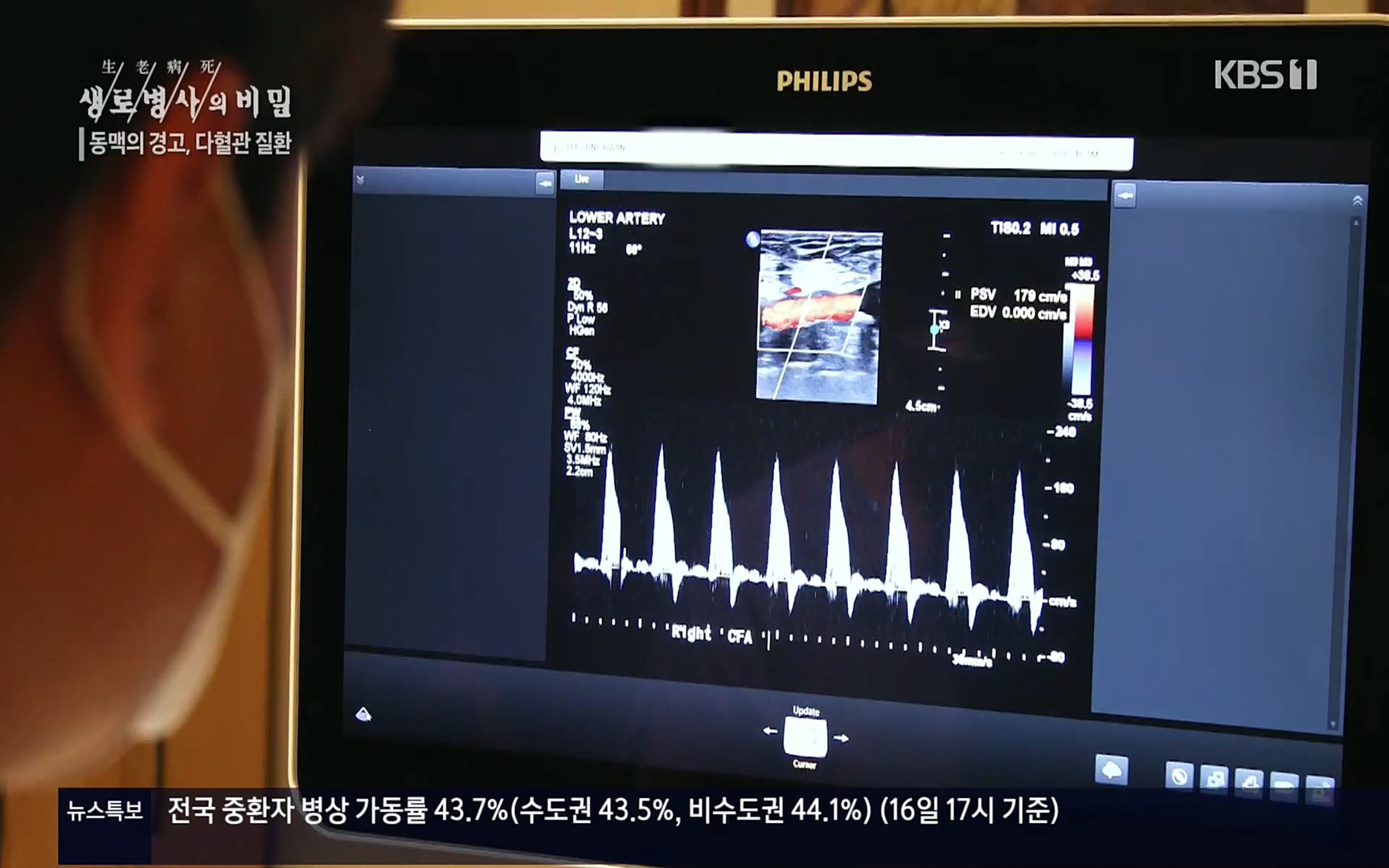 생로병사의 비밀.E831.220817p.H264-F1RST.mp4_20220822_185324.186.jpg