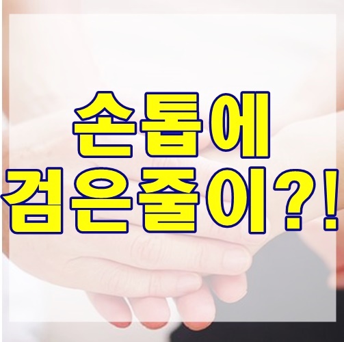  손톱 검은 세로줄 생기는 원인은?