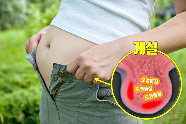 배를 찌르는 듯한 통증 게실염의 증상 복부팽만