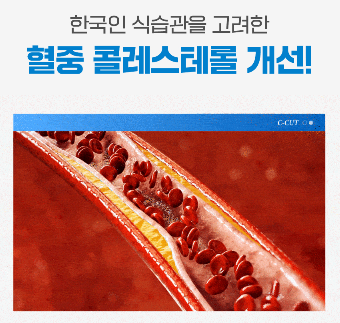 씨커트 부작용에 관한 글 혈관 모양 사진