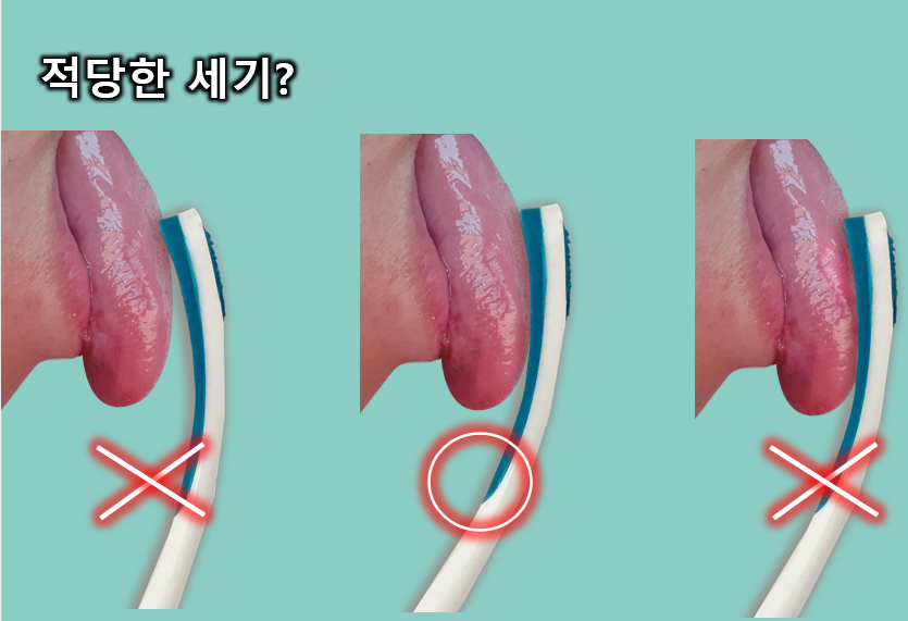 혀 클리너 사용법, 혀 백태가 생기는 이유와 제거까지 구강내과의사가 알려드림