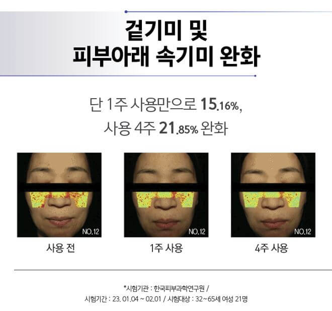 태극제약의 도미나스 제품의 효과를 나타내기위해 사용전&#44; 1주사용&#44;4주 사용의 변화를 나타내는 이미지