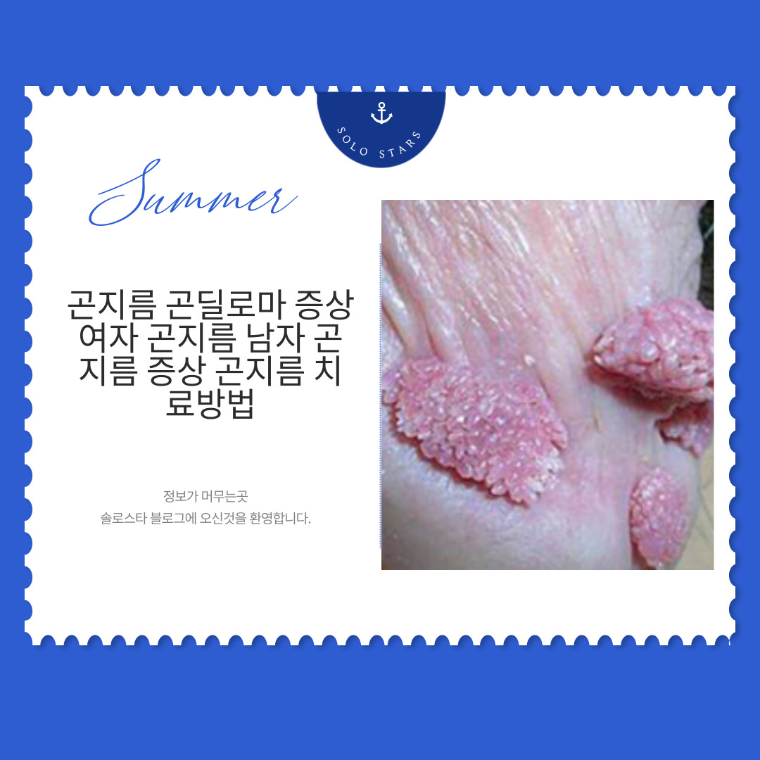 곤지름 사진