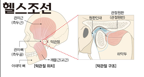 턱관절 구조