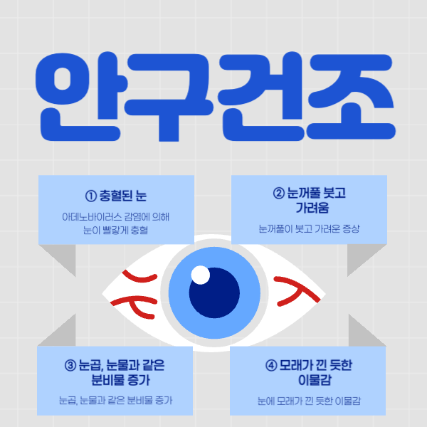 안구건조증의 원인, 증상 및 예방 방법