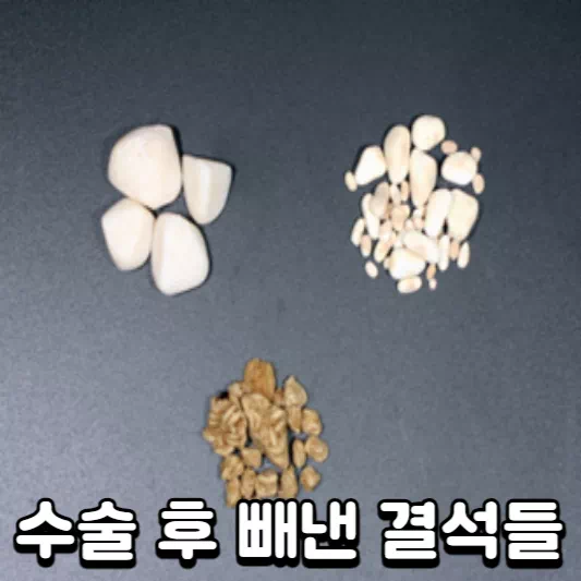 강아지-요로결석
강아지-요로결석-수술
강아지-요로결석-치료비용
강아지-요로
강아지-방광염