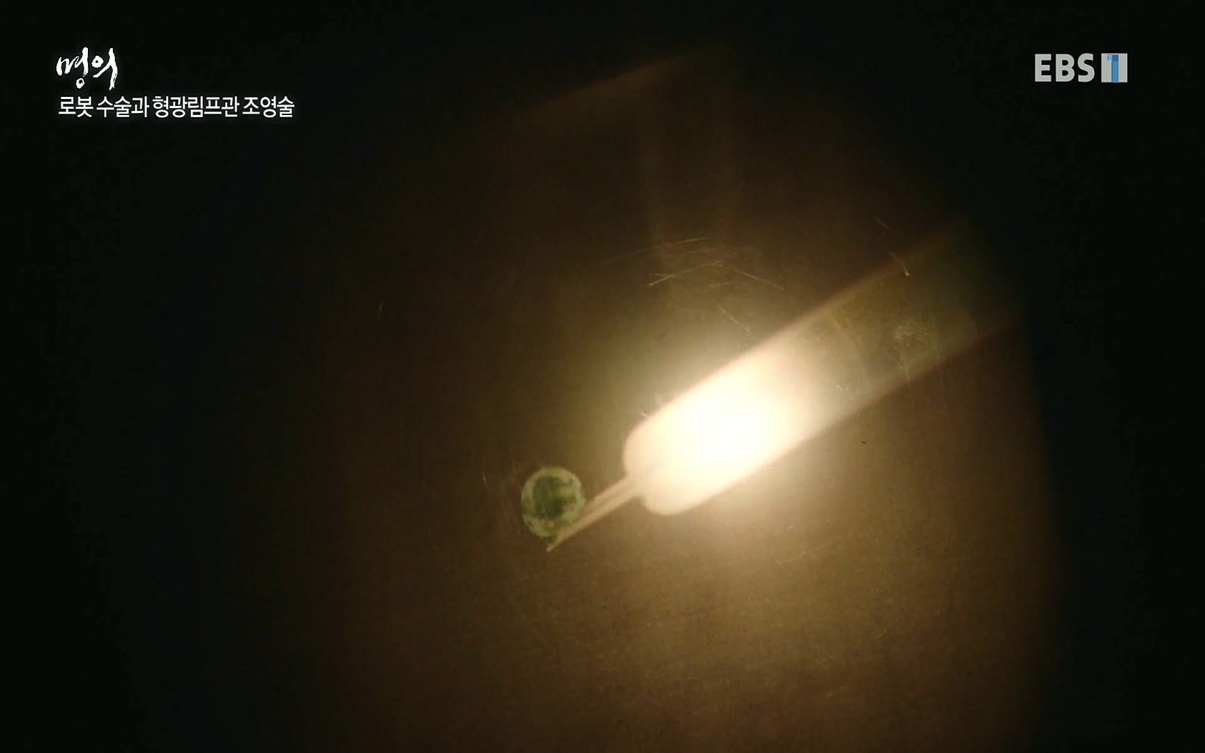 EBS 명의 헬스케어 - TV - 교육의 중심 EBS명의 15년, 위암 치료 이렇게 달라졌다!.mp4_20220809_203716.554.jpg