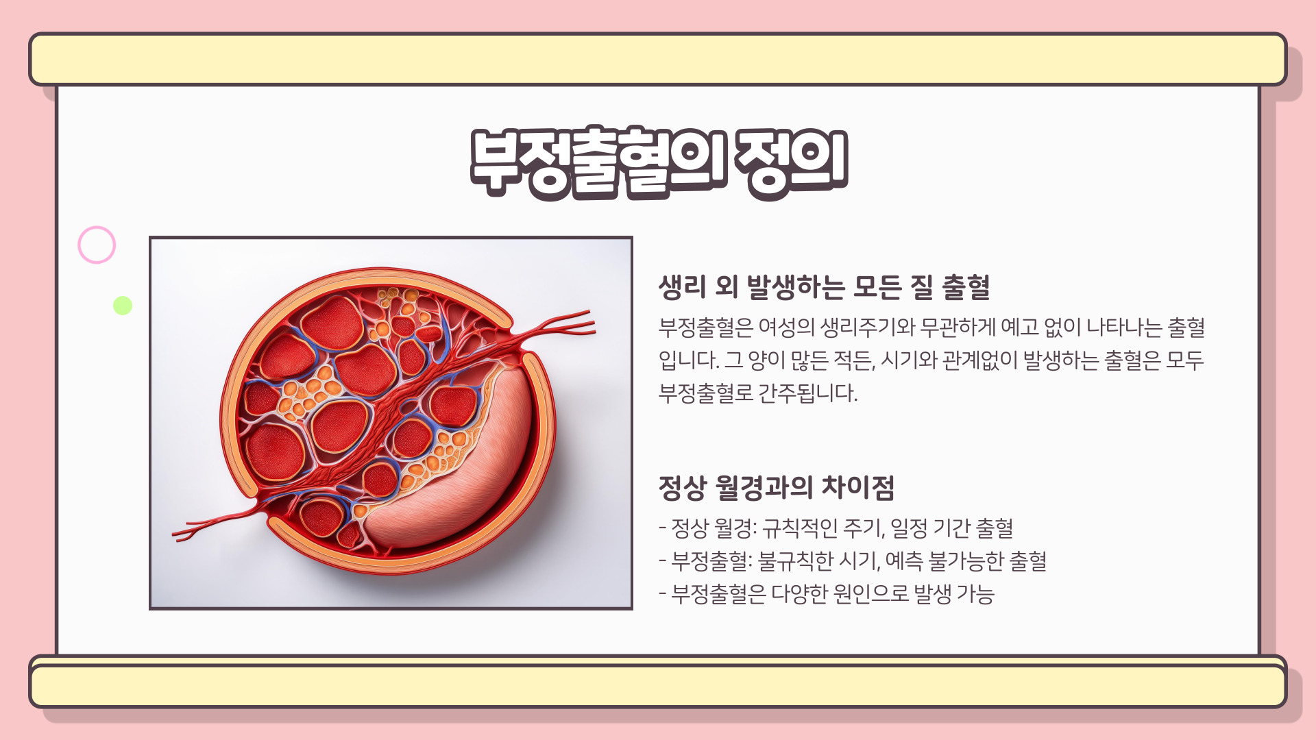 부정출혈 원인과 치료