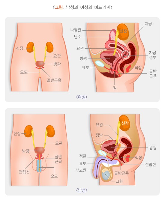 요실금 수술 방법