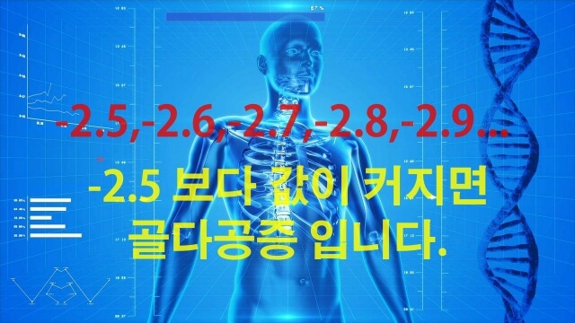 골밀도 검사 결과 값 해석법