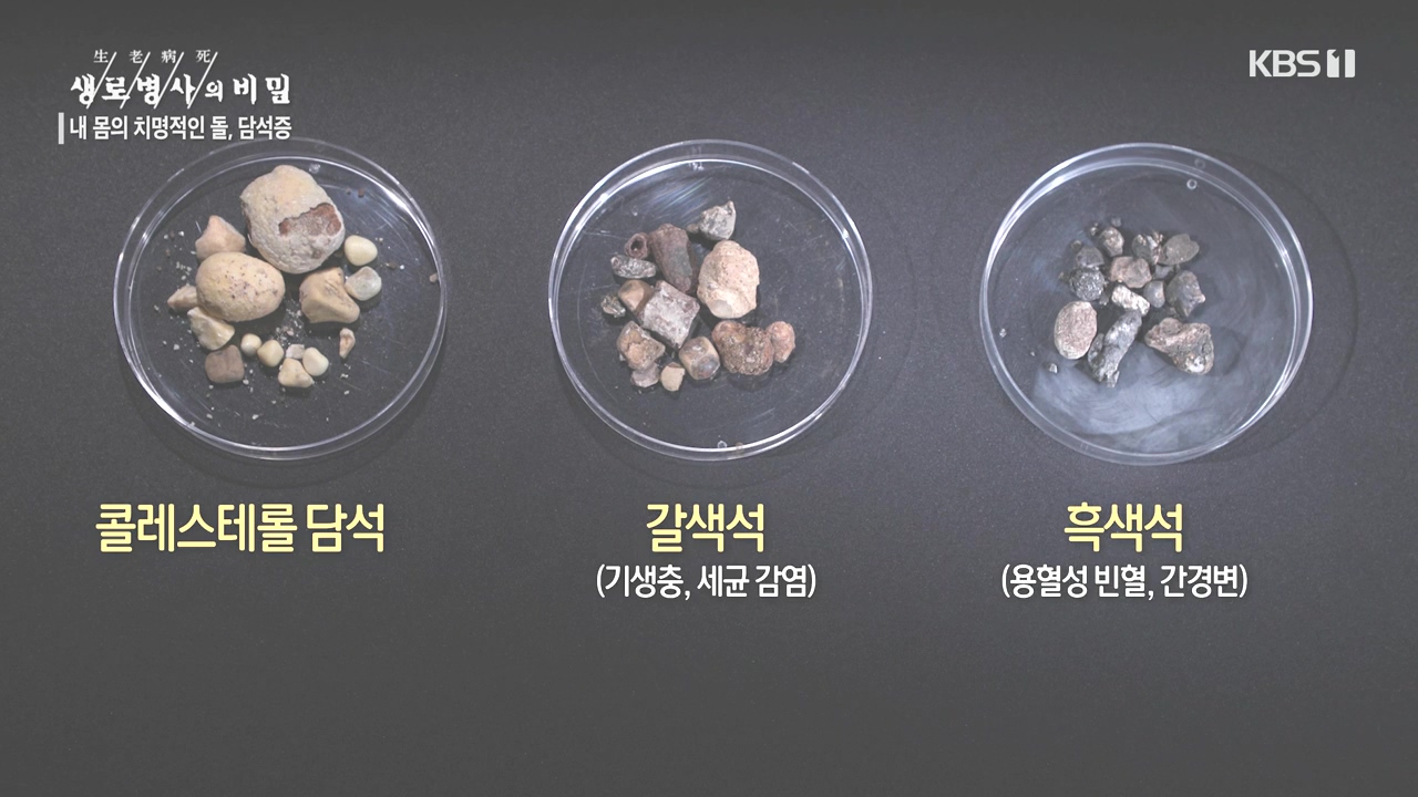 생로병사의 비밀.E886.231019p-NEXT.mp4_20231019_201752.574.jpg