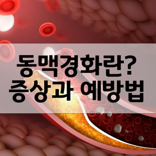 동맥경화 증상과 예방법