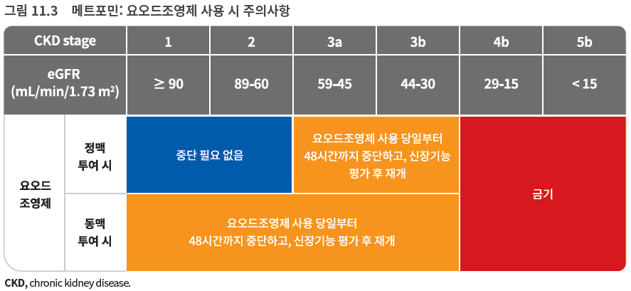 메트포민: 요오드조영제 사용 시 주의사항
