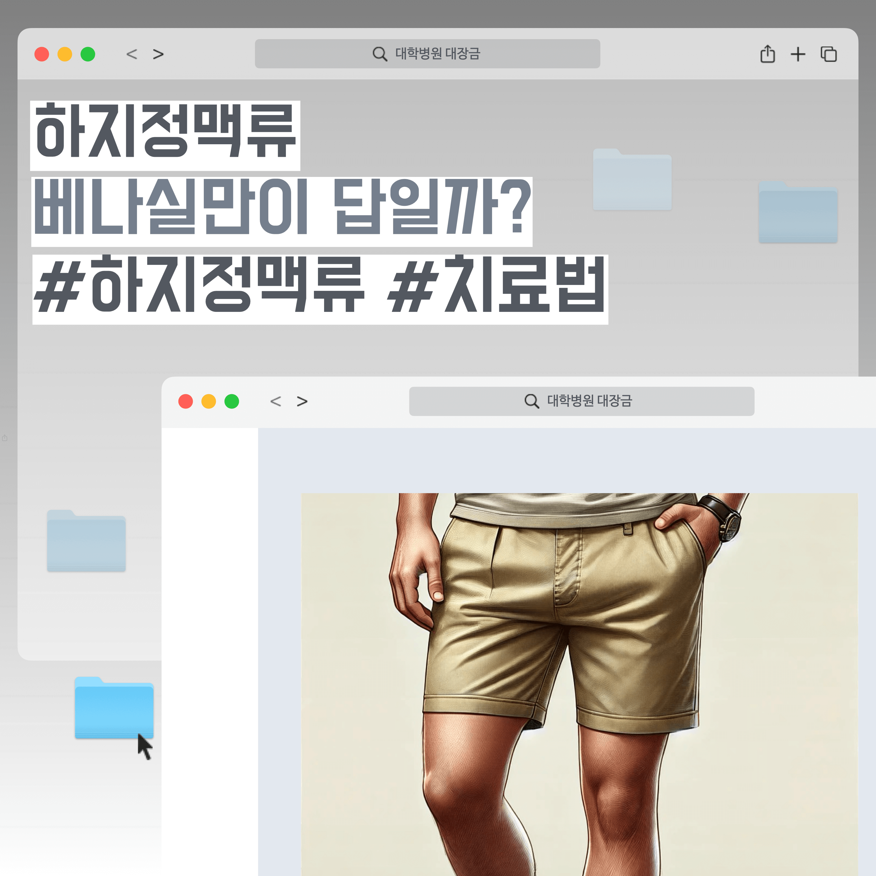 하지정맥류, 베나실만이 답일까?