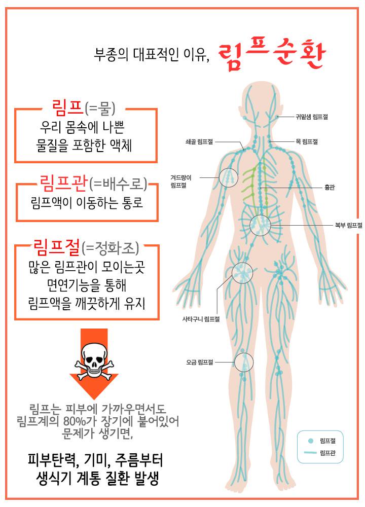  림프순환 부종