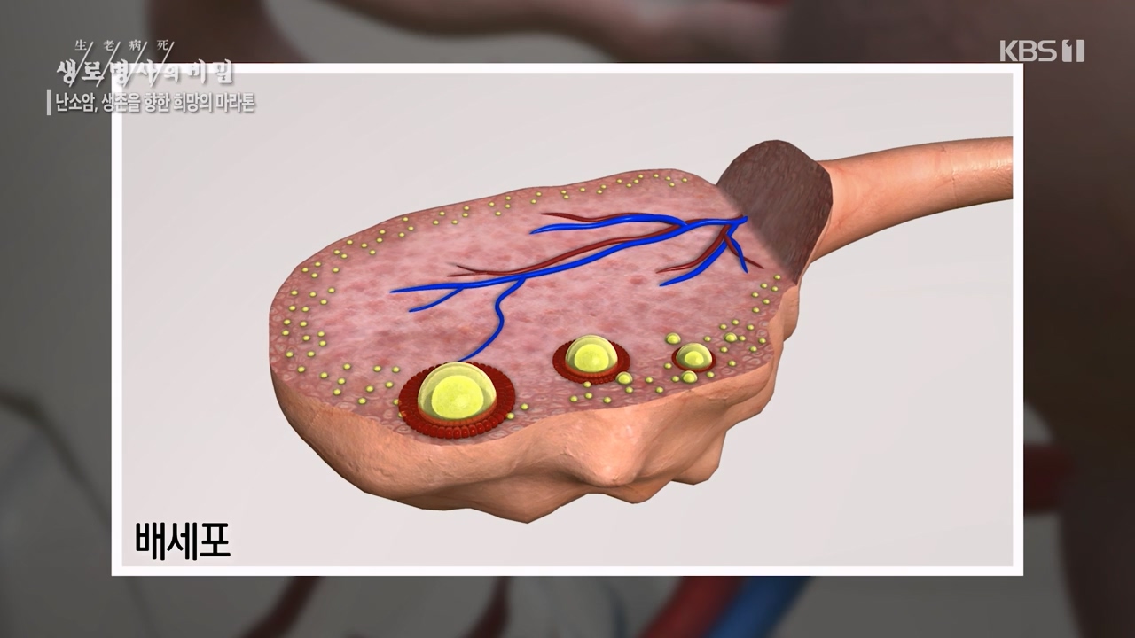 생로병사의 비밀.E878.230803p-NEXT.mp4_20230805_155629.940.jpg