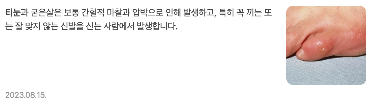 티눈 설명 사진