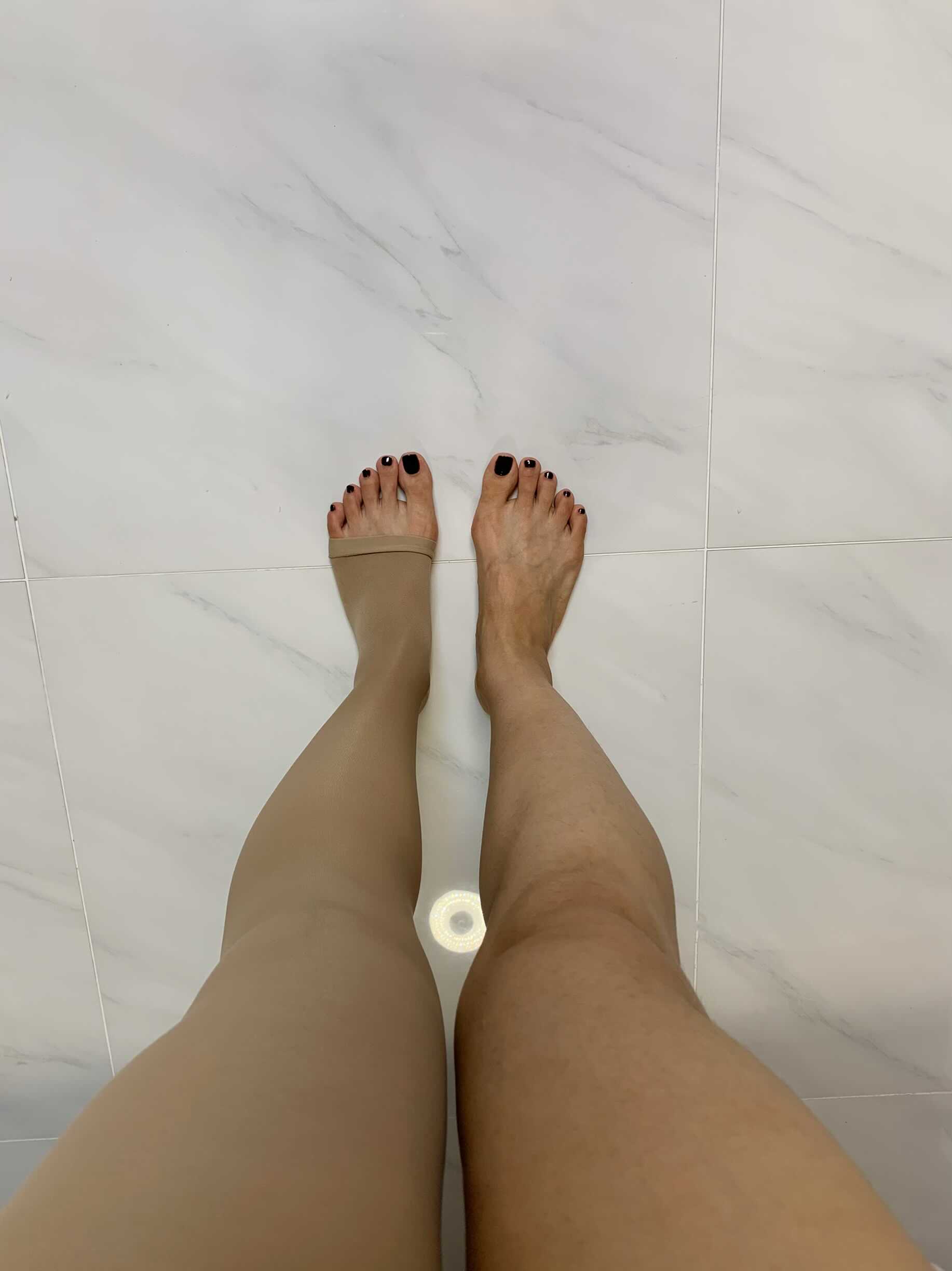  다리 부기 하지정맥류 의료용 압박스타킹 추천
