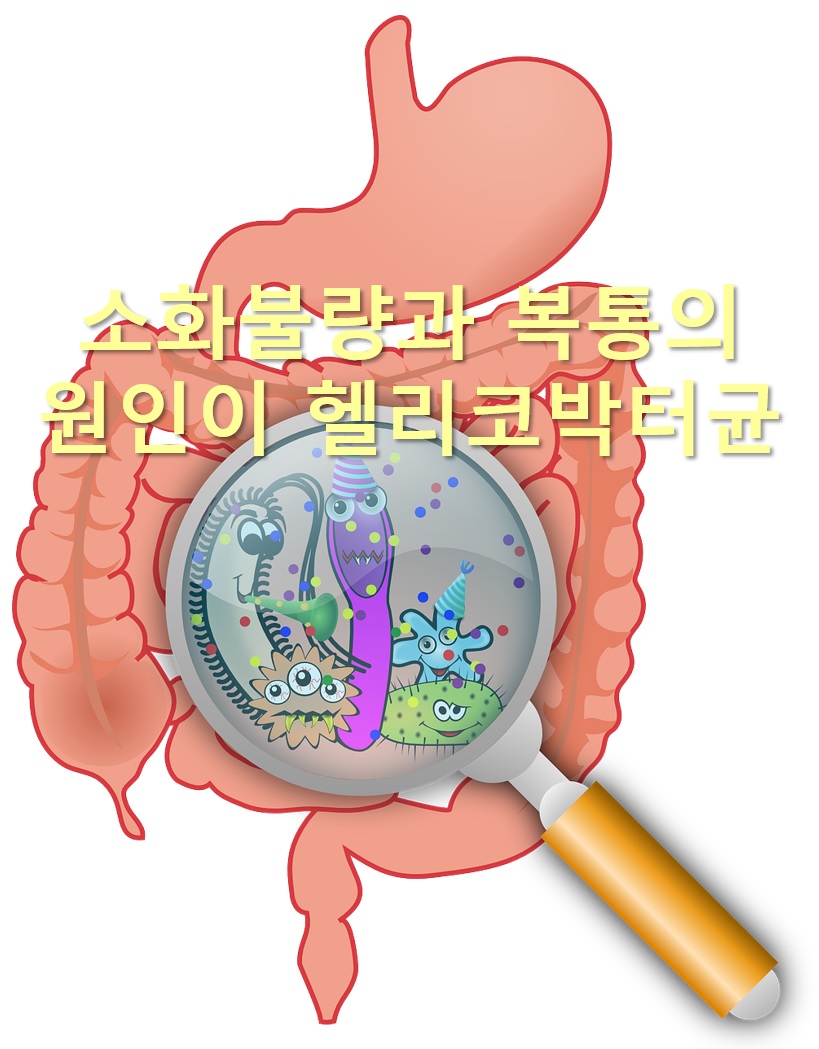  소화불량과 복통의 원인이 헬리코박터균?